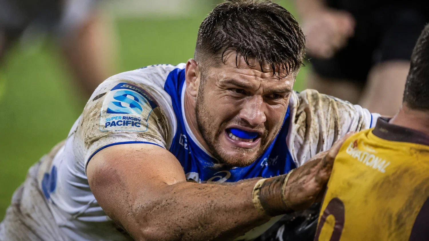 Why Wear a Custom Mouthguard for Rugby? Expert Safety Guide